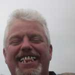 Man i have to see my dentist soon!