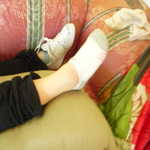 Now who's swollen ankle can that be? Why of course, Deanna's.